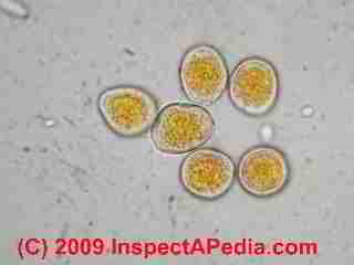 Uredinospores (C) Daniel Friedman
